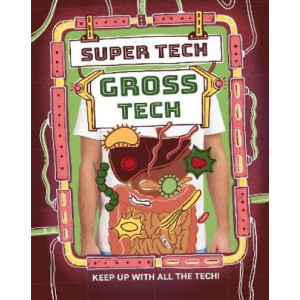 Super Tech: Gross Tech