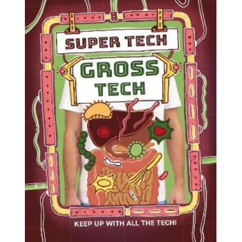 Super Tech: Gross Tech